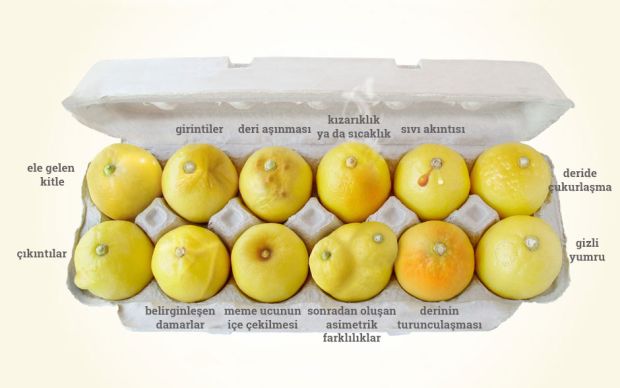 meme-kanserini-anlatan-limonlar